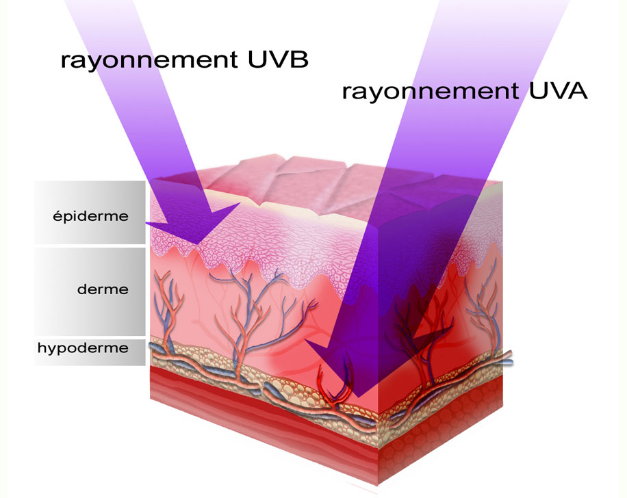 UV