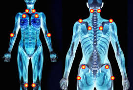 FIBROMYALGIE POINTS photo:radio