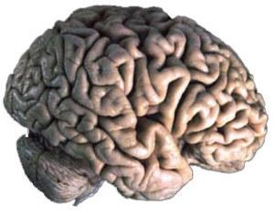 CERVEAU IMAGE